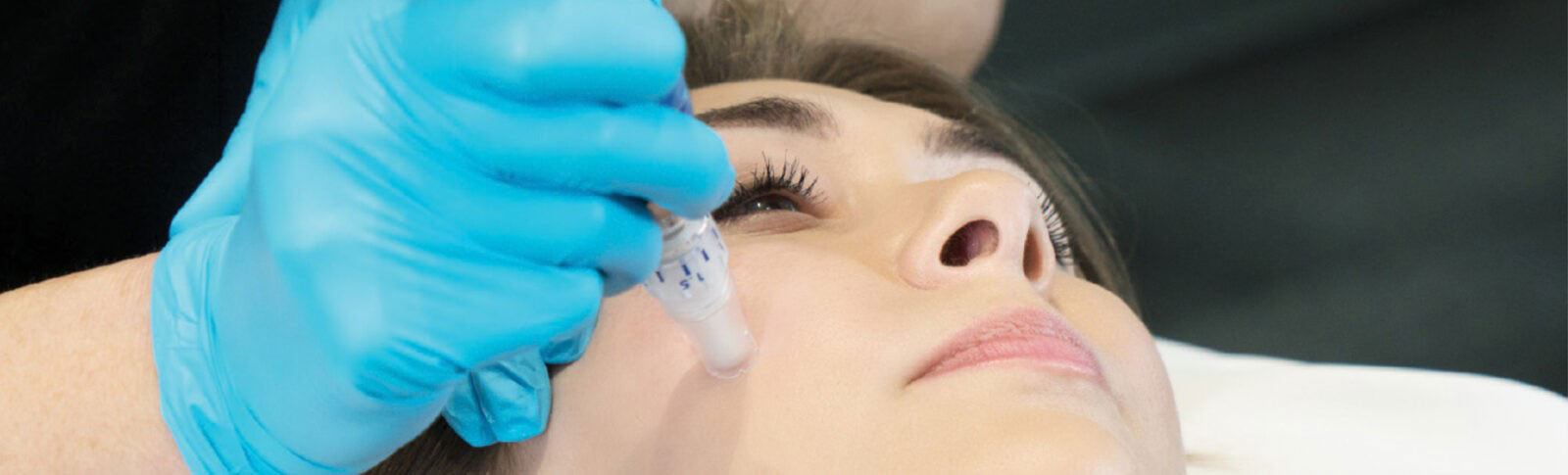 Microneedling Services Innovative Aesthetics Medical Spa and Laser Center