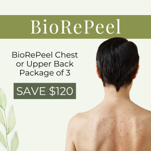 BioRePeels: Upper Back or Chest  Package of 3